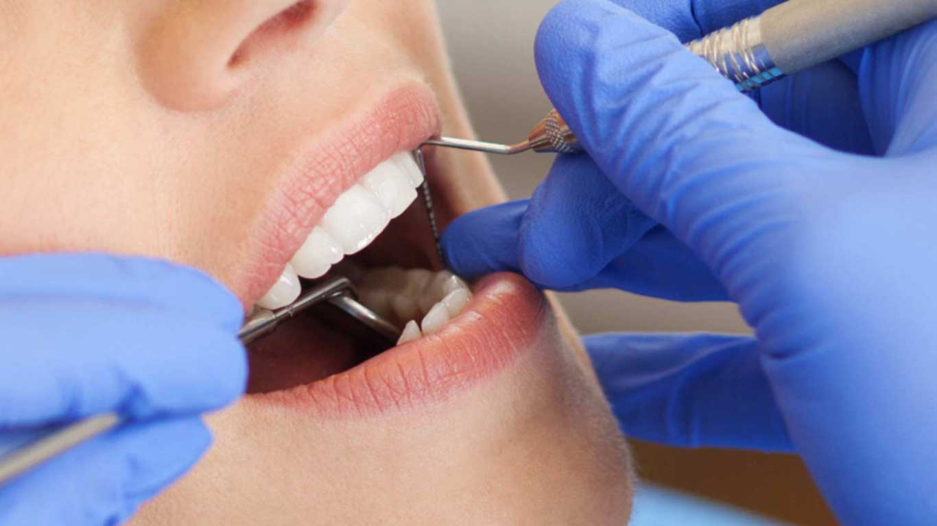 علاج عصب الاسنان (حشو العصب )- عيادة أسنان أوبتمم كير - د. هبة عمار - استشاري تجميل الاسنان و التركيبات